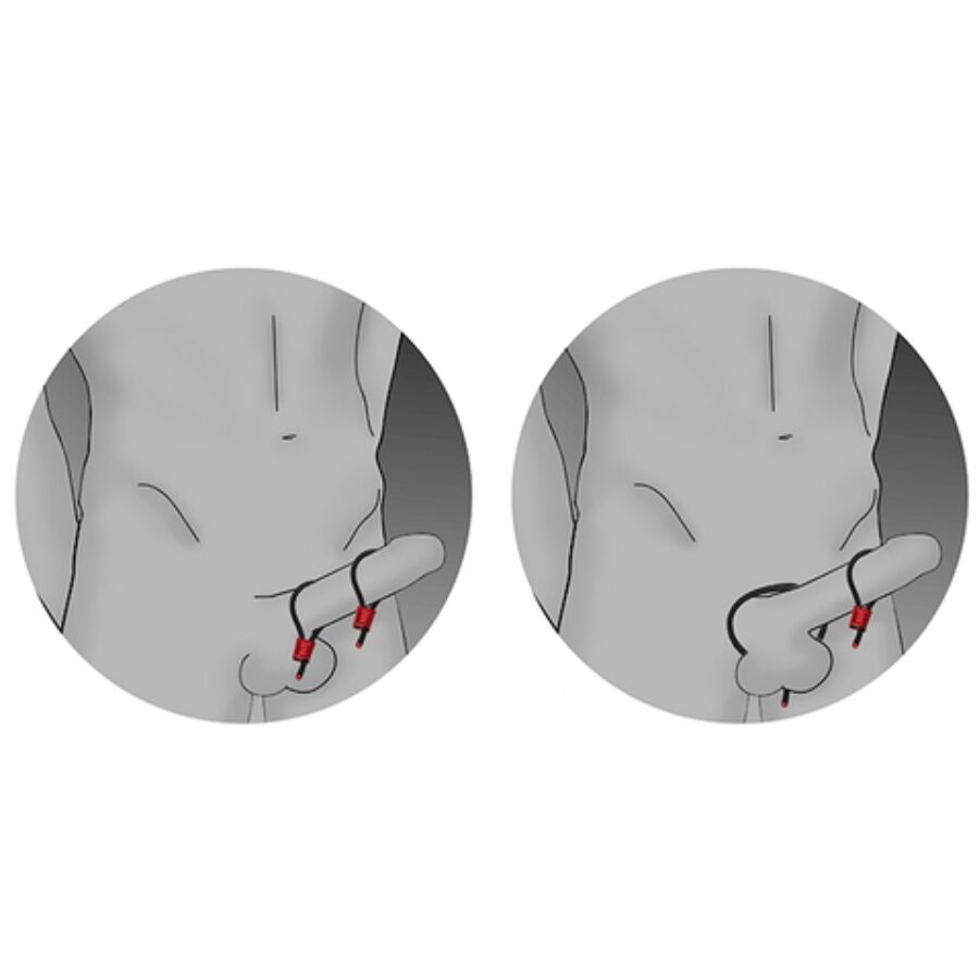 ELECTRASTIM - PRESTIGE ELECTRA LOOPS ANELLI PER IL PENE REGOLABILI ROSSI - immagine 3