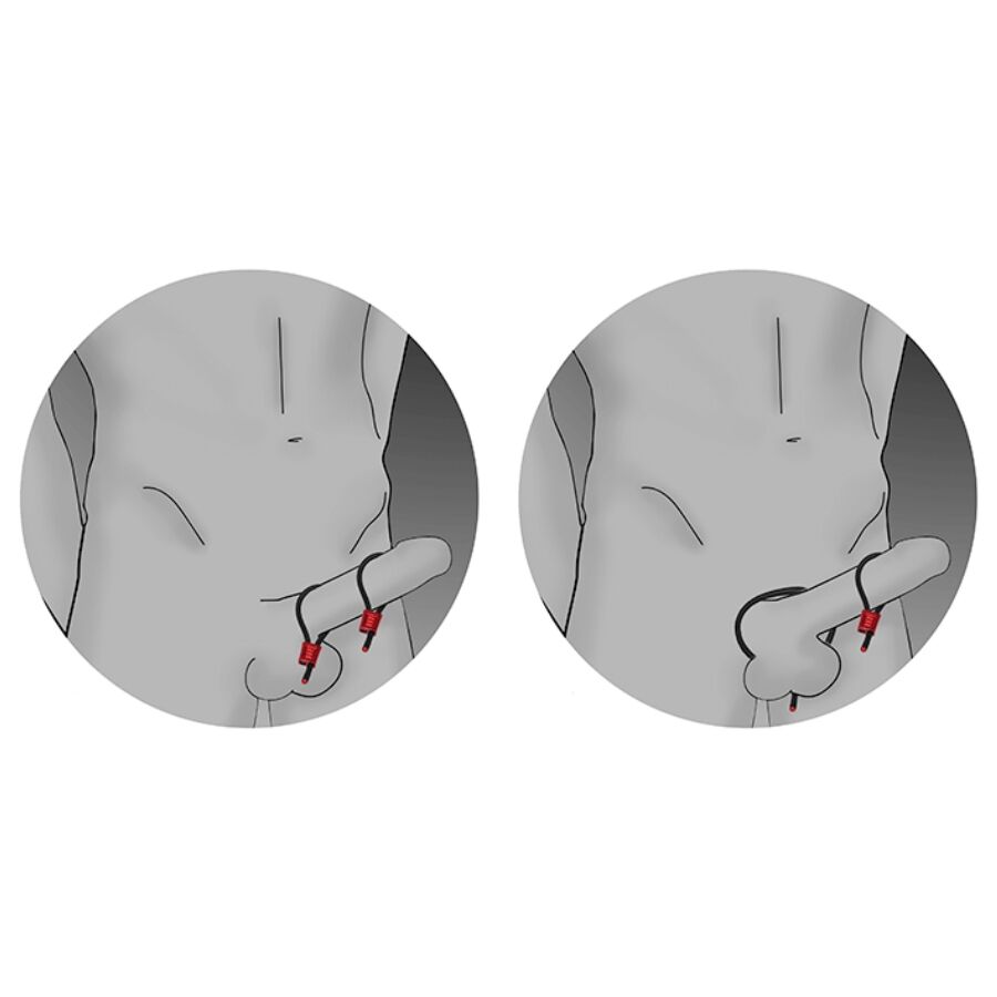 ELECTRASTIM - PRESTIGE ELECTRA LOOPS ANELLI PER IL PENE REGOLABILI NERI - immagine 2